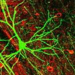 پرورش «مغز» انسان در ابعاد کوچک با استفاده از سلول‌های بنیادی