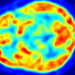 الگوریتمی که آلزایمر را شش سال زودتر از پزشکان تشخیص می‌دهد
